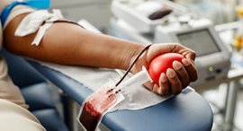 Epatite contratta per emotrasfusione: il sinistro stradale non è causa ma mero antecedente